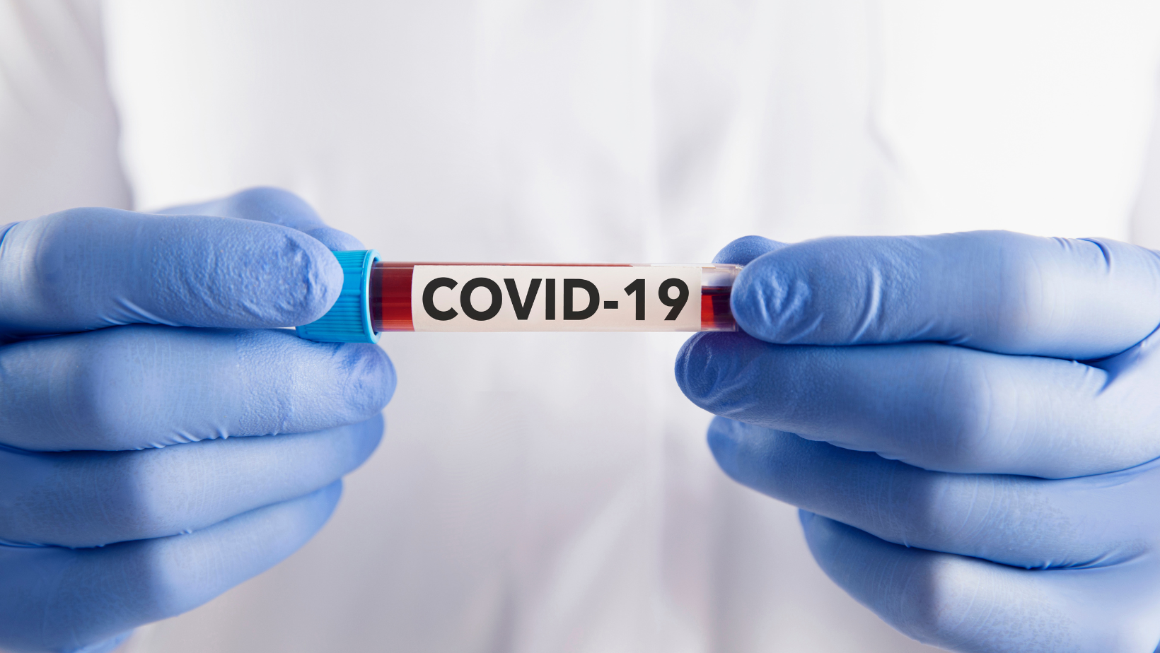 From Tests to Vaccines: MSSUs Health Center Offers Comprehensive COVID-19 Support